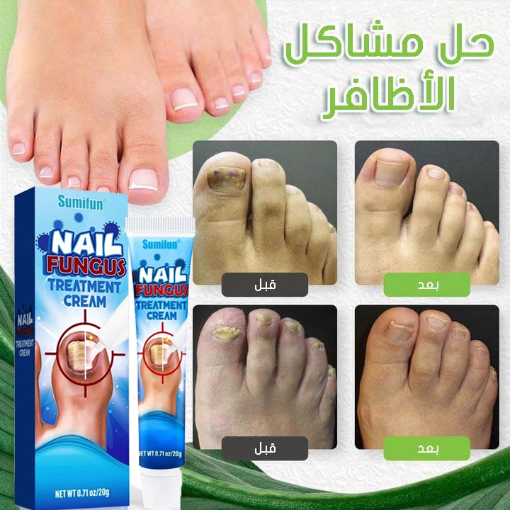 مرهم العناية بالاظافر